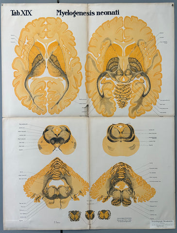 Link to  Myelogenesis neonati ChartGermany, c. 1928  Product