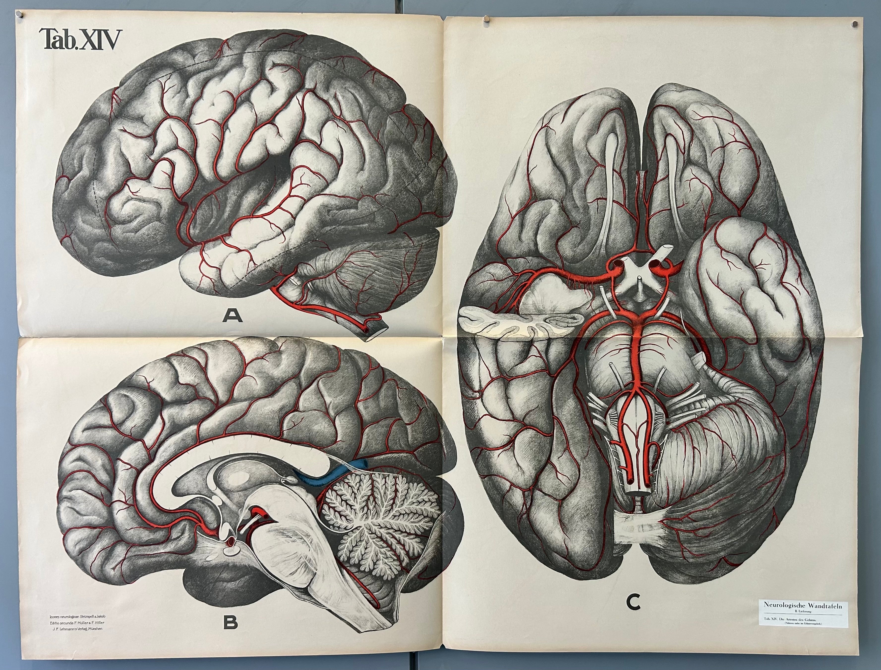 Aerial, and side profiles, of the different sections of the brain. Brain is drawn in black and white, the arteries are drawn in red.