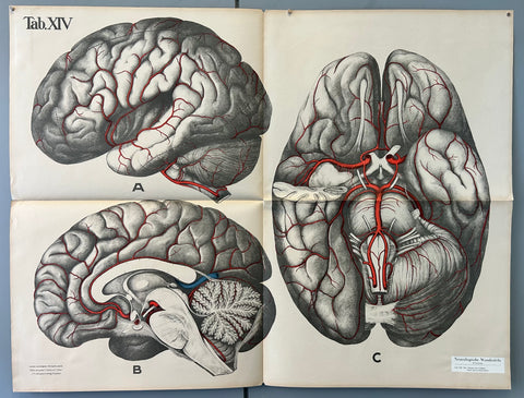 Link to  Brain Arteries ChartGermany, c. 1928  Product